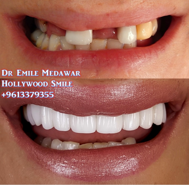 Dentist in Beirut Lebanon