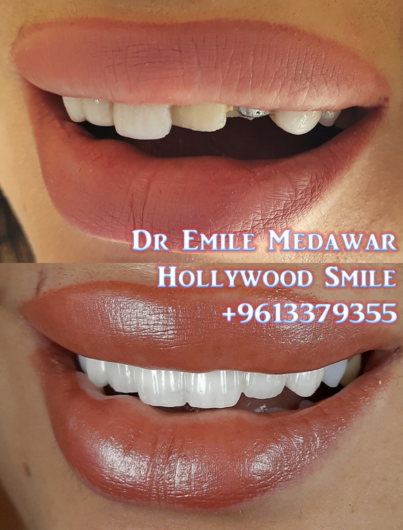 Dentist in Beirut Lebanon