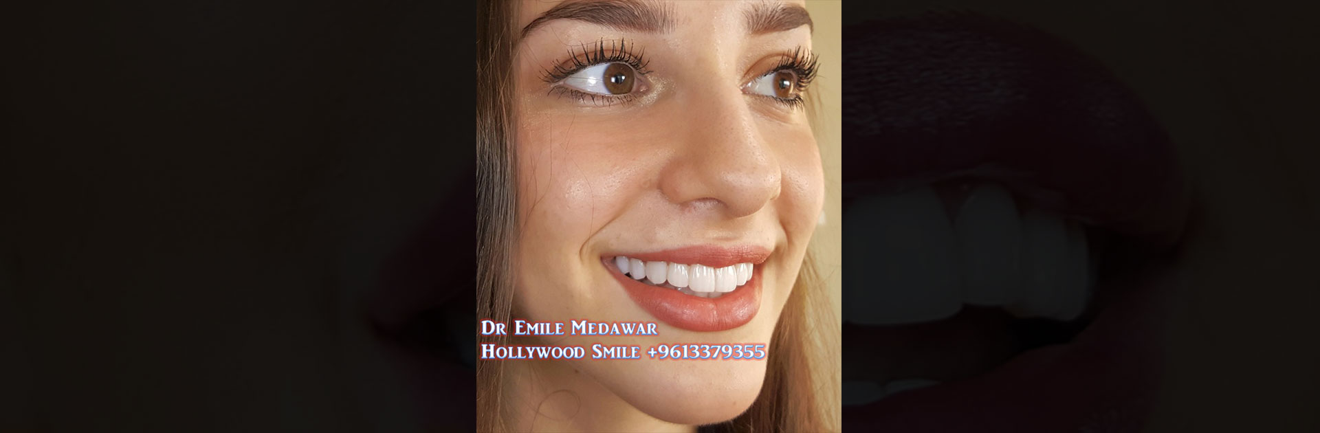 dental clinic beirut