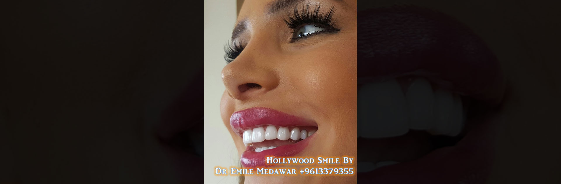 best dentist in lebanon