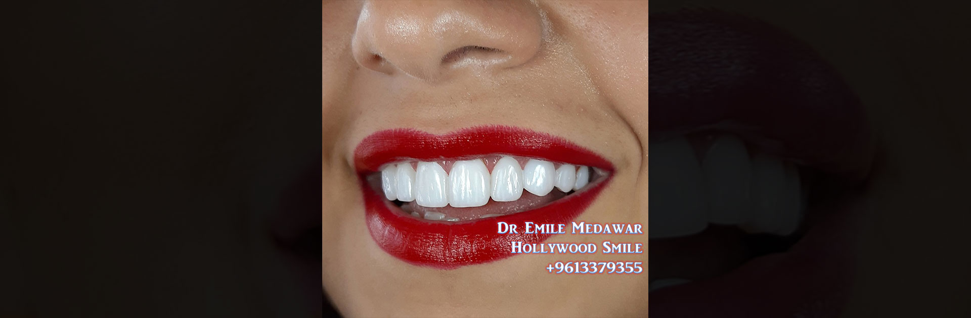 dentist lebanon beirut