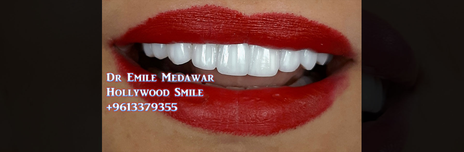 طبيب اسنان لبنان