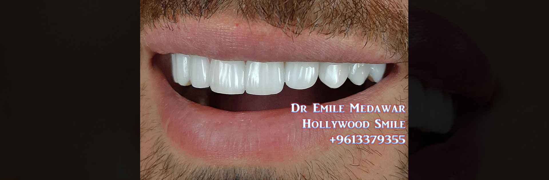 dental clinic lebanon